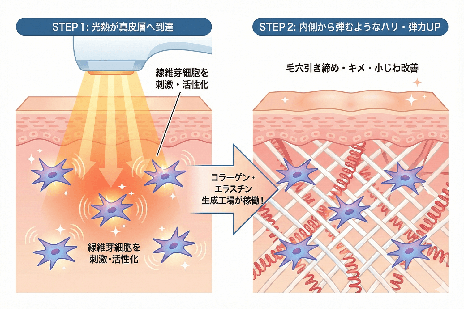 真皮層のコラーゲン生成イメージ