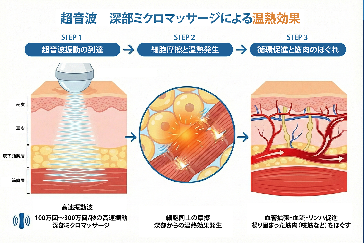 超音波施術のイメージ
