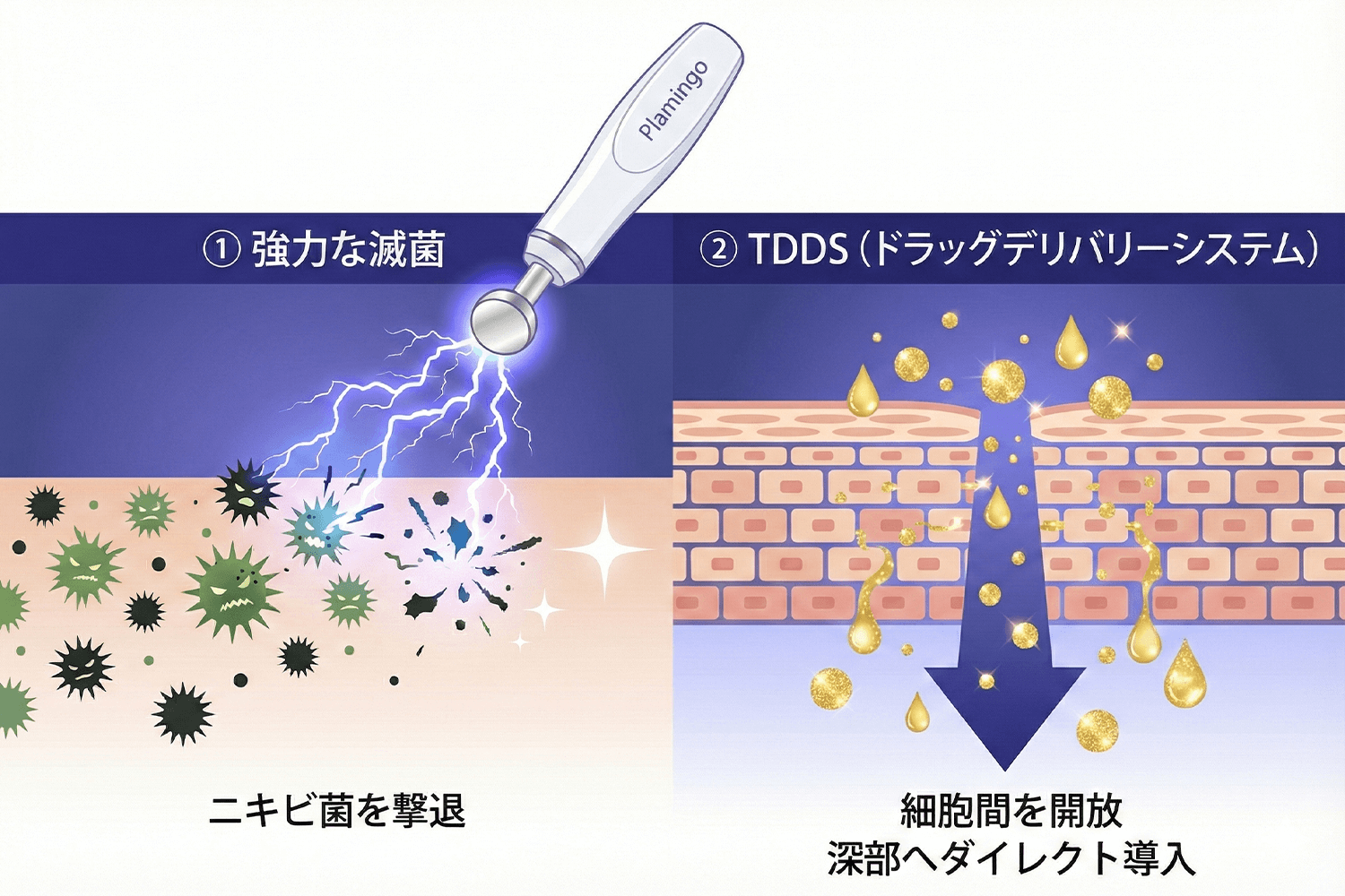 プラズマ照射のイメージ