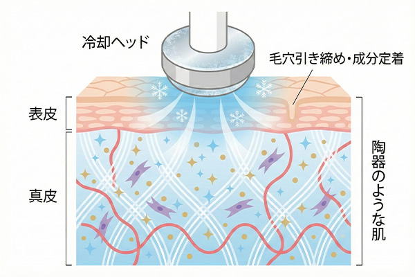 クライオ冷却のイメージ