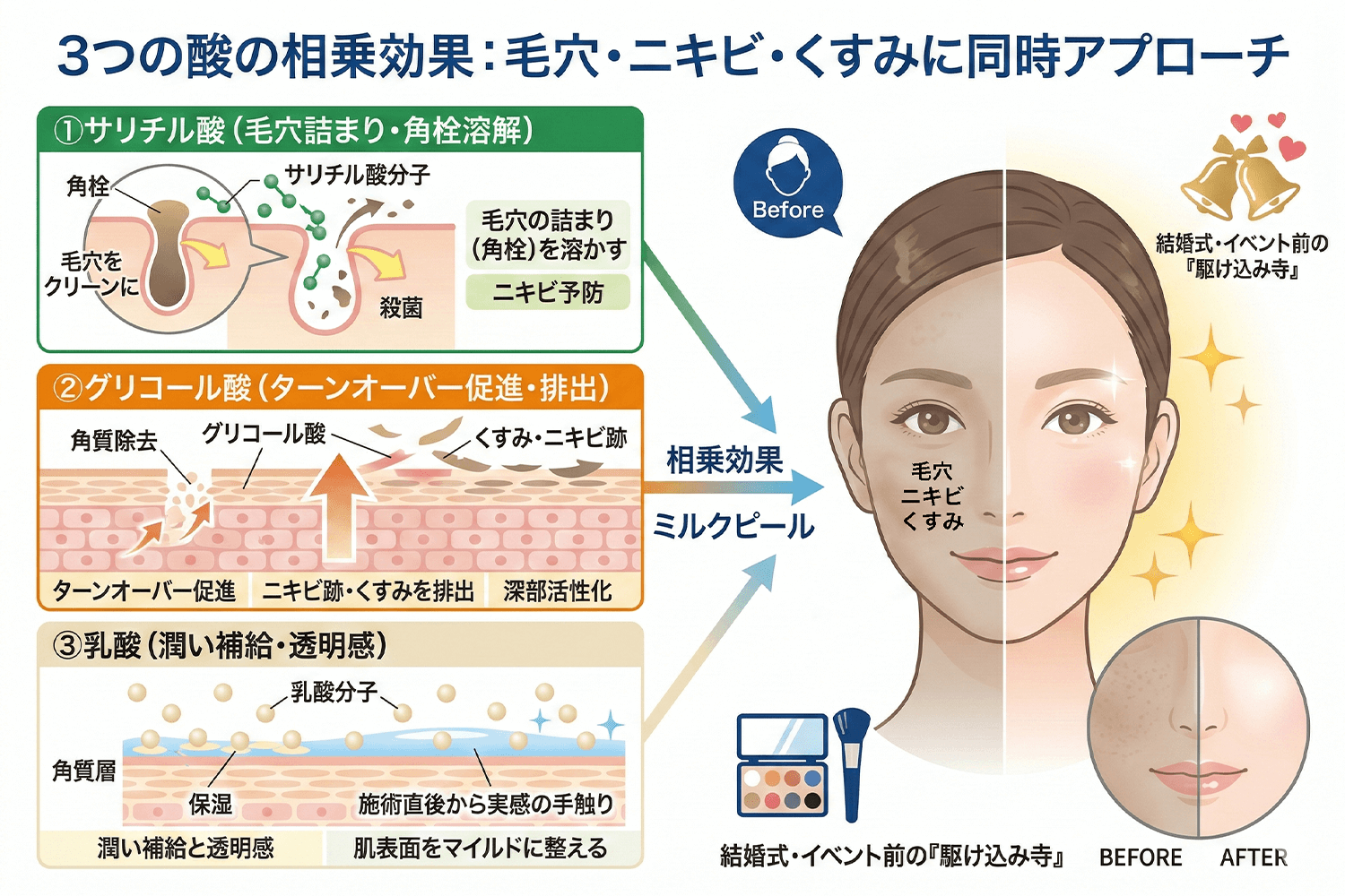 毛穴・キメ改善のイメージ